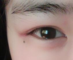右下眼睑内有痣的女人