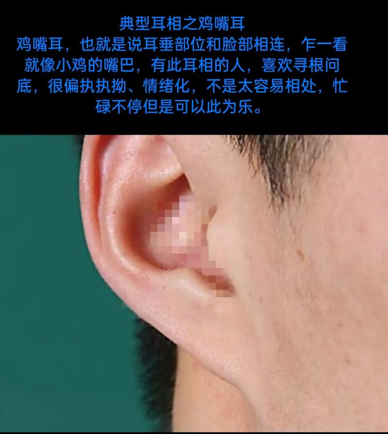 耳朵卷起来的人面相
