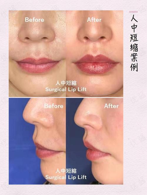 人中短浅的人晚景如何