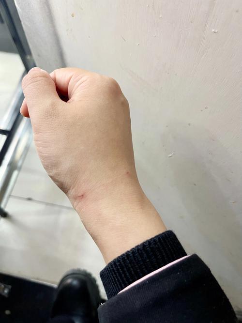 梦到被猫咬手不放是什么意思