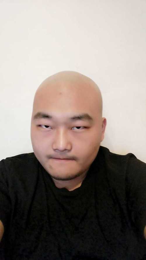 梦见别人秃顶