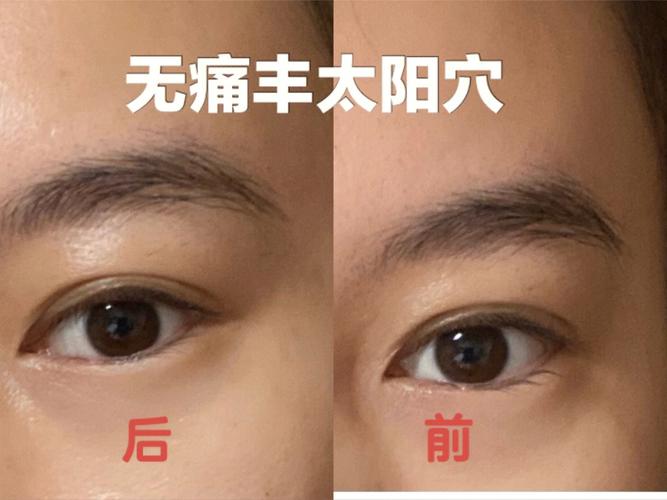 太阳穴凹陷的人人生运势会受到什么影响