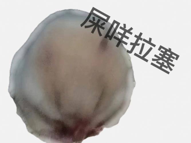 大概是咩屎了!做梦居然梦到大便,怎么解?