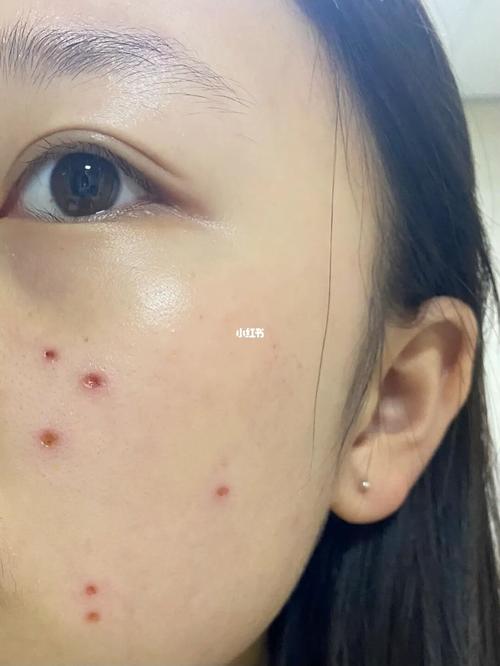 左脸一直跳预示着什么