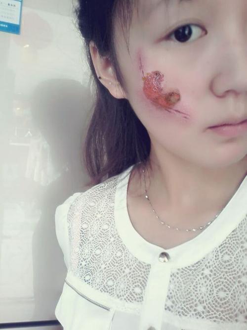 脸上有疤痕的人命苦