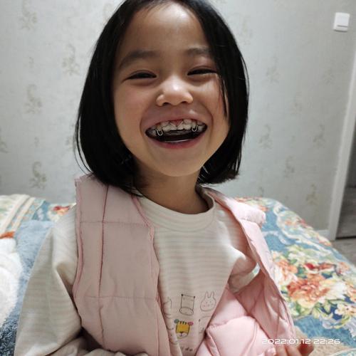 地包天有什么寓意