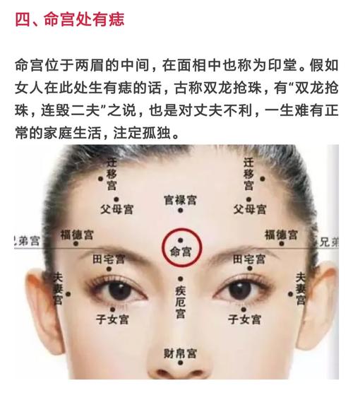 脑门上长痣好吗