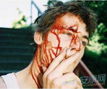 梦见自己头上流血