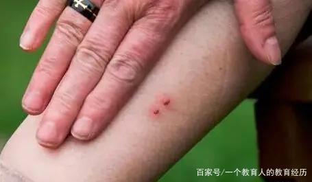 属蛇被甩后会怎样舔伤口