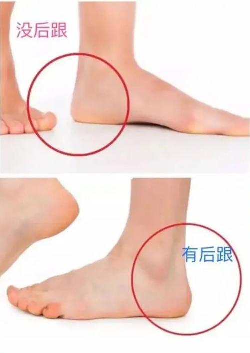 没有脚后跟的女人命运