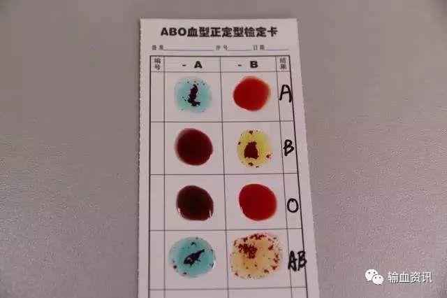 盘点不同血型面对意外之财的反应