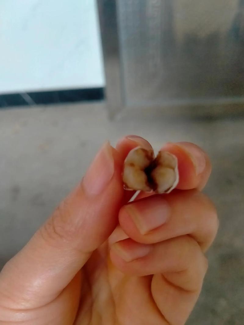 梦到坏牙被自己拔下来了