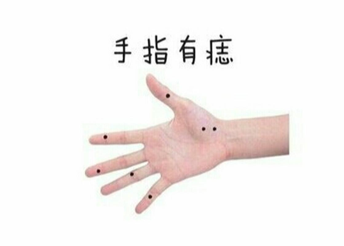 左手大拇指抖动痣相