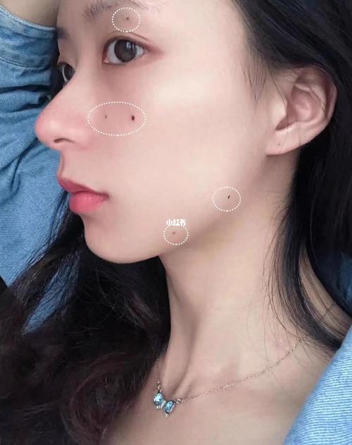 梦见自己脸上有疤是什么意思