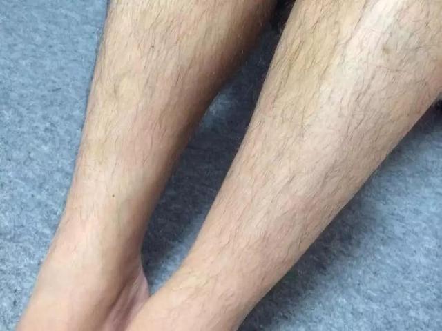 体毛如何看体相?体毛浓密的人命好吗?