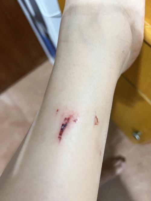 孕妇梦见抓螃蟹和鱼,梦见抓螃蟹