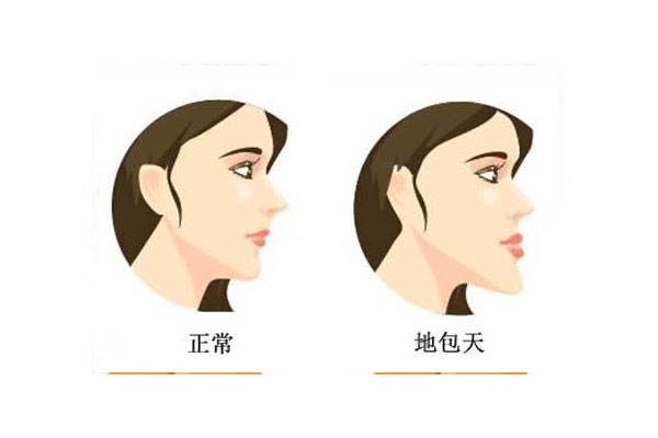地包天好不好命