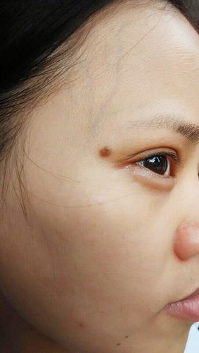 女人右眼上面有痣