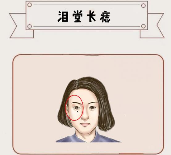 哪些痣相特征的人最容易欠下情债