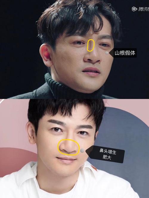 鼻头有垂肉的男性对感情会不会负责?鼻头有肉的人好不好?