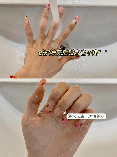 梦见手背裂开