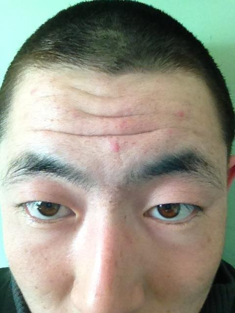 抬头纹很深的男人好不好