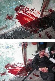 梦见打架拿刀砍死人