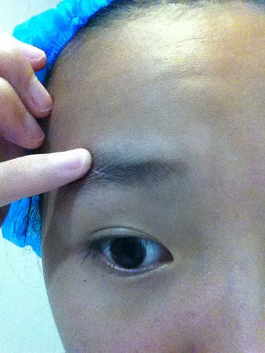 右边眉毛长白毛贵人