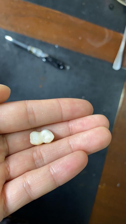 梦见自己掉了两颗牙