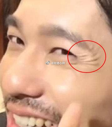 鱼尾纹杂乱的面相是属于离婚之相吗