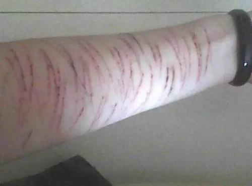 梦见黑鸟落手臂上