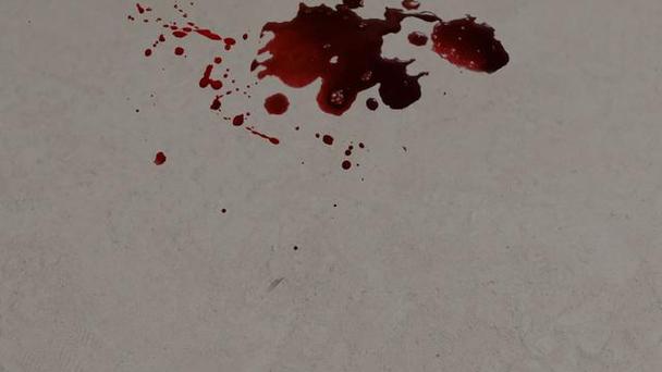 梦见死人眼流血