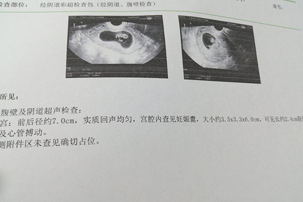 怀上贵子的征兆,前三个月怀男孩有什么特征