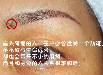 一夜暴富痣 眉毛中有痣的人一生衣食无忧