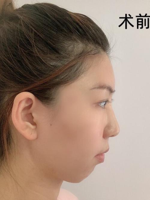 女孩下巴短好不好