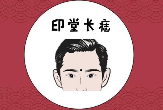 男人额头凹陷印堂有痣好吗