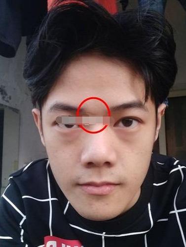 男人眼白有痣非常人