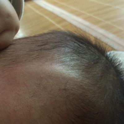 宝宝额头两边骨头突出好不好