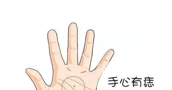 事业线穿过红痣好吗