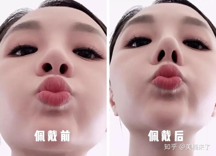 梦见自己的鼻孔大了好吗