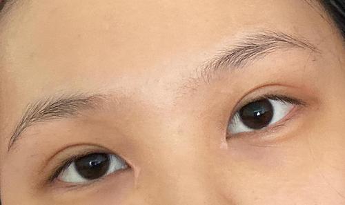 右眼角有疤是上天嫉妒