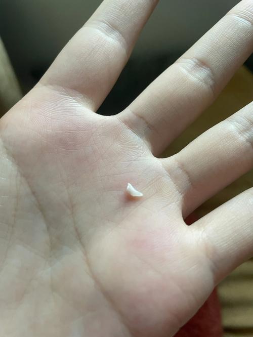 下门牙掉了一颗预示着什么