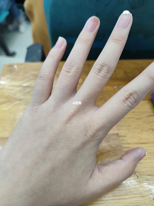 女孩子手很粗糙纹路多代表什么