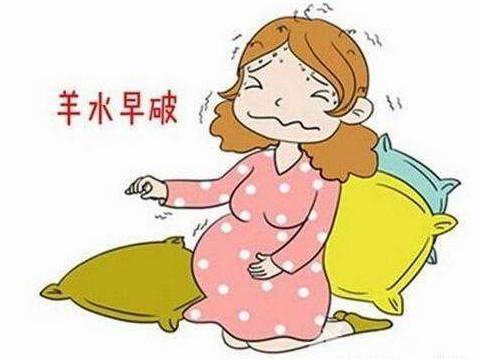 梦见孕妇快生了