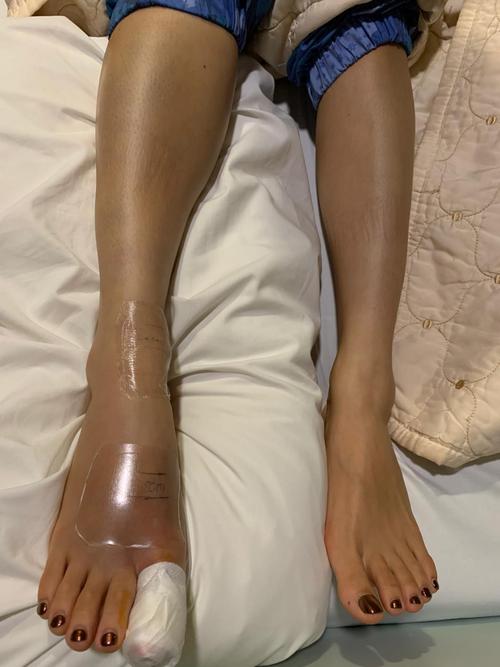 梦见被小青蛇咬是什么意思