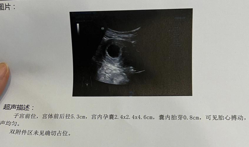 梦见小奶狗什么意思
