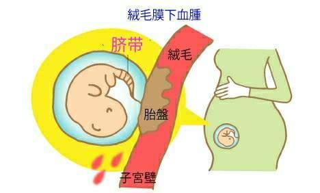莫方!梦见已婚妇女怀孕吉凶指数90以上