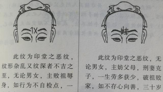 男性印堂生有杂纹代表什么