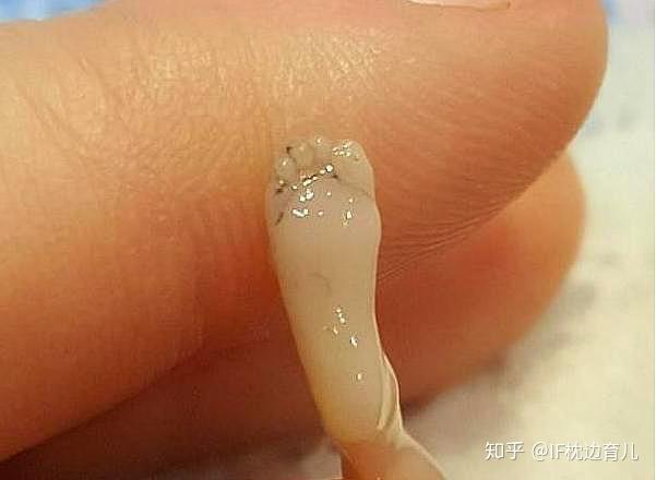 有这特征的女人暗示打过胎