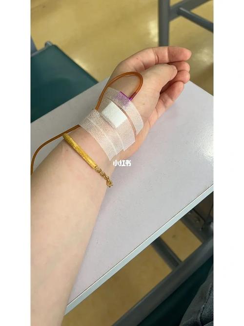 梦见打针肿了,身心疲劳